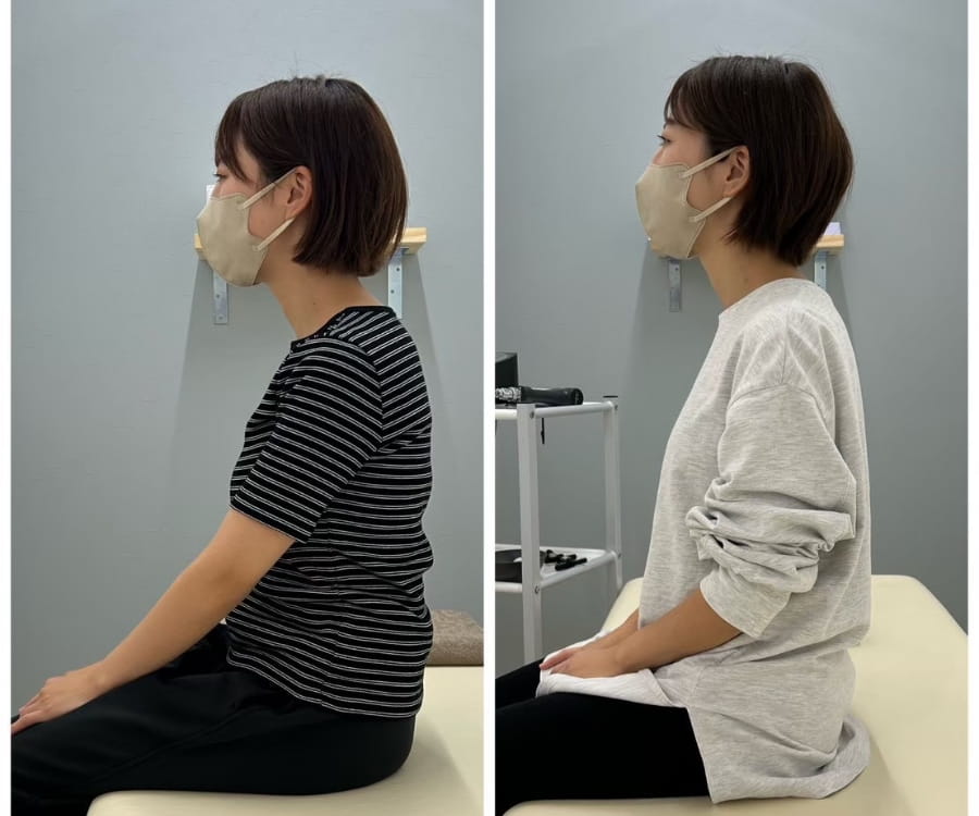 大府市の女性の姿勢のビフォーアフター